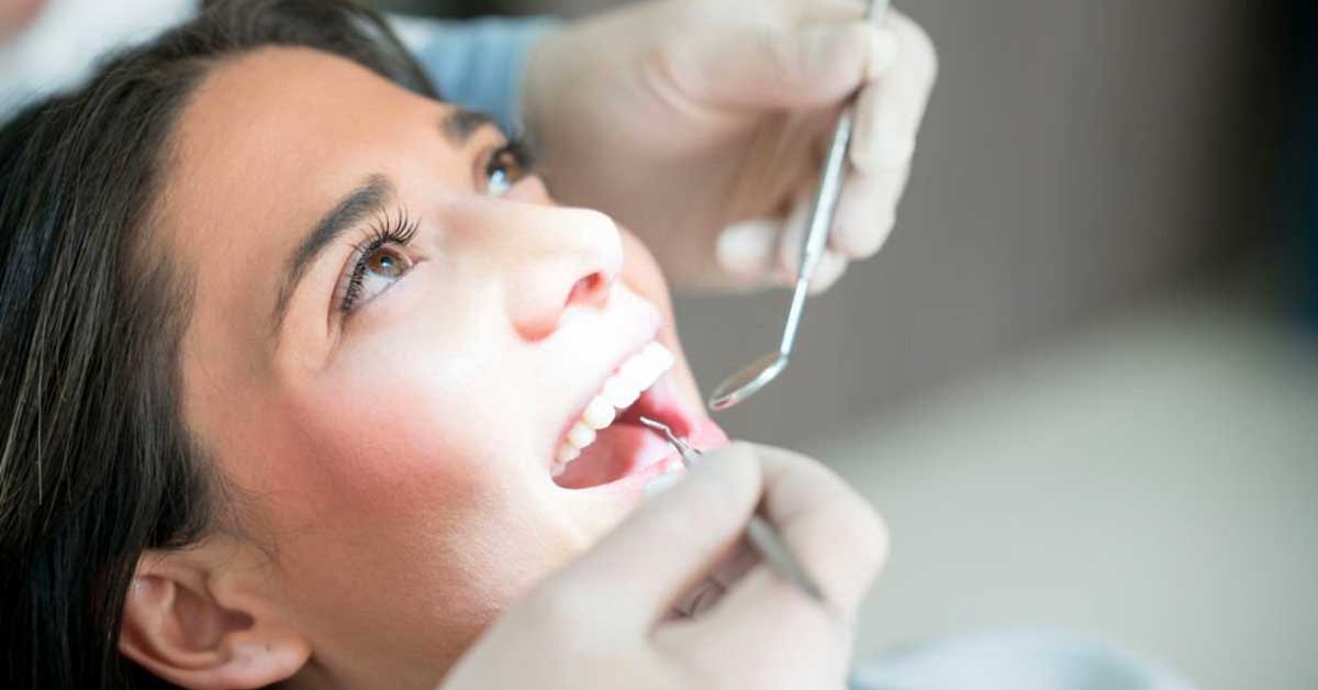 What Types of Crowns Are Available?