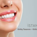 İstanbul Gülüş Tasarımı – İstanbul Gülüş Estetiği