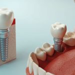 Diş Hekimliği Dünyasında Yeni Teknolojiler