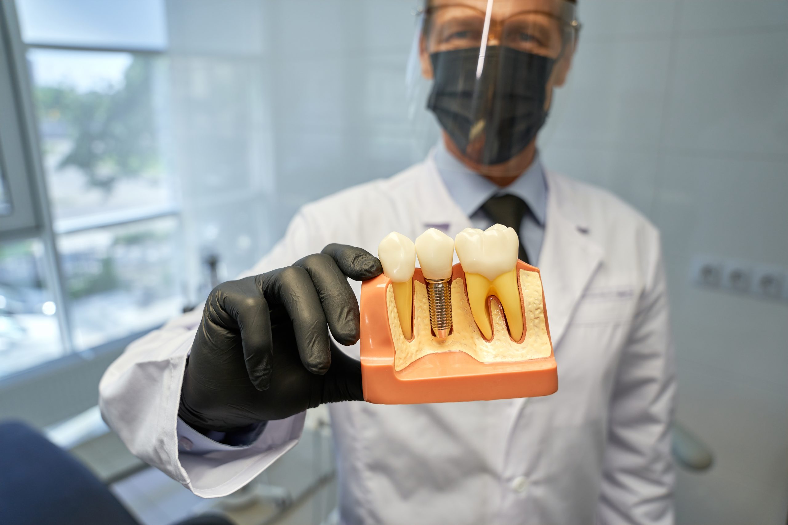 ankara implant