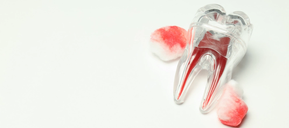 diş eti kanaması neden olur