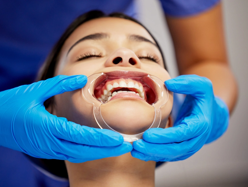 üst çene implant bekleme süresi